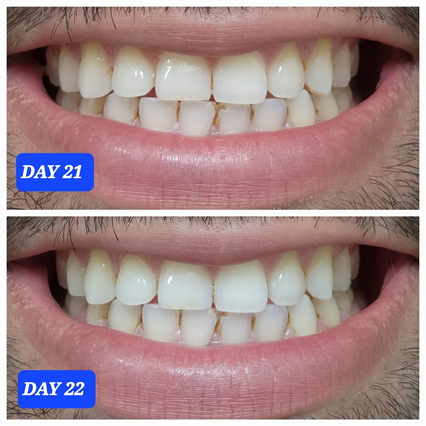 Crest 3D Whitestrips Professional Effects, Enamel Safe Teeth Whitening Kit, 22 Treatments (44 Strips), Professional-Level Whitening, 19 Levels Whiter customer photo 1