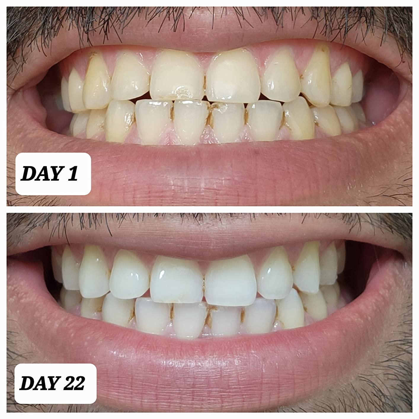 Crest 3D Whitestrips Professional Effects, Enamel Safe Teeth Whitening Kit, 22 Treatments (44 Strips), Professional-Level Whitening, 19 Levels Whiter customer photo 2