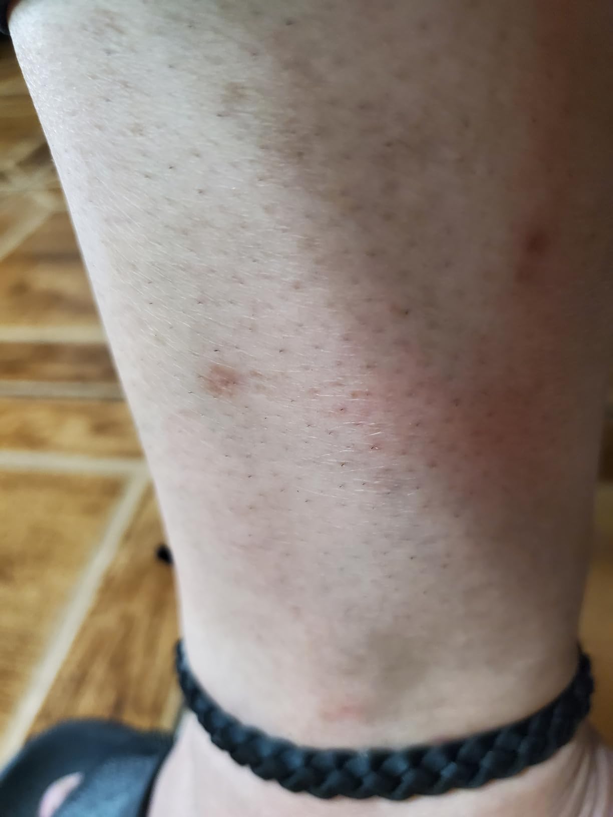 Bear Grylls Mosquito Repellent Bracelets | DEET-Free | 10 Pack customer photo 2
